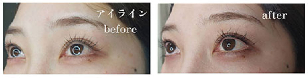 アイライン